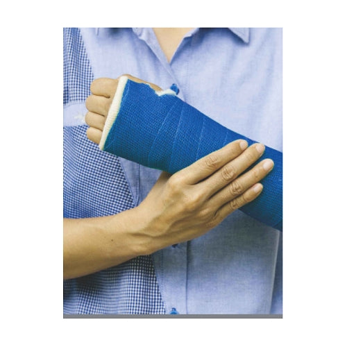 NOVA CAST Fiberglass Casting Tape-HEALTH &PERSONAL CARE-dealsplant